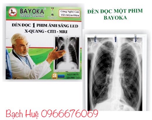 Đèn đọc 1 phim X Quang Bayoka
